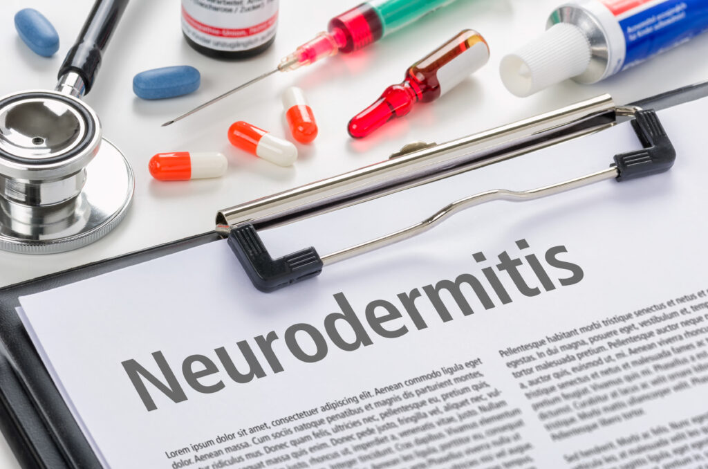 Neurodermitis Medikamente