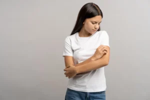 Mädchen mit Neurodermitis am Arm kratzt sich